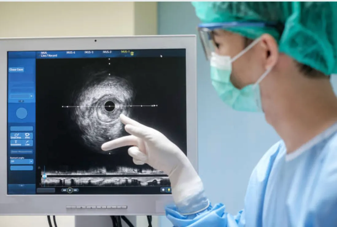 Real IVUS imaging showing artery cross-section