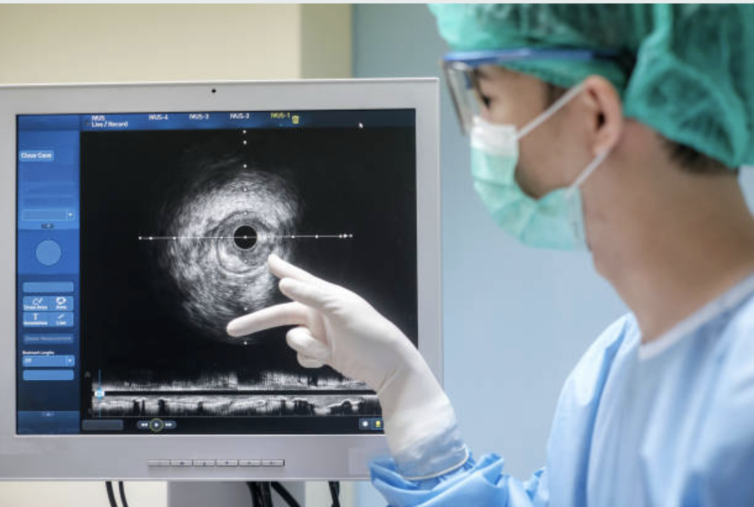 Real IVUS imaging showing artery cross-section