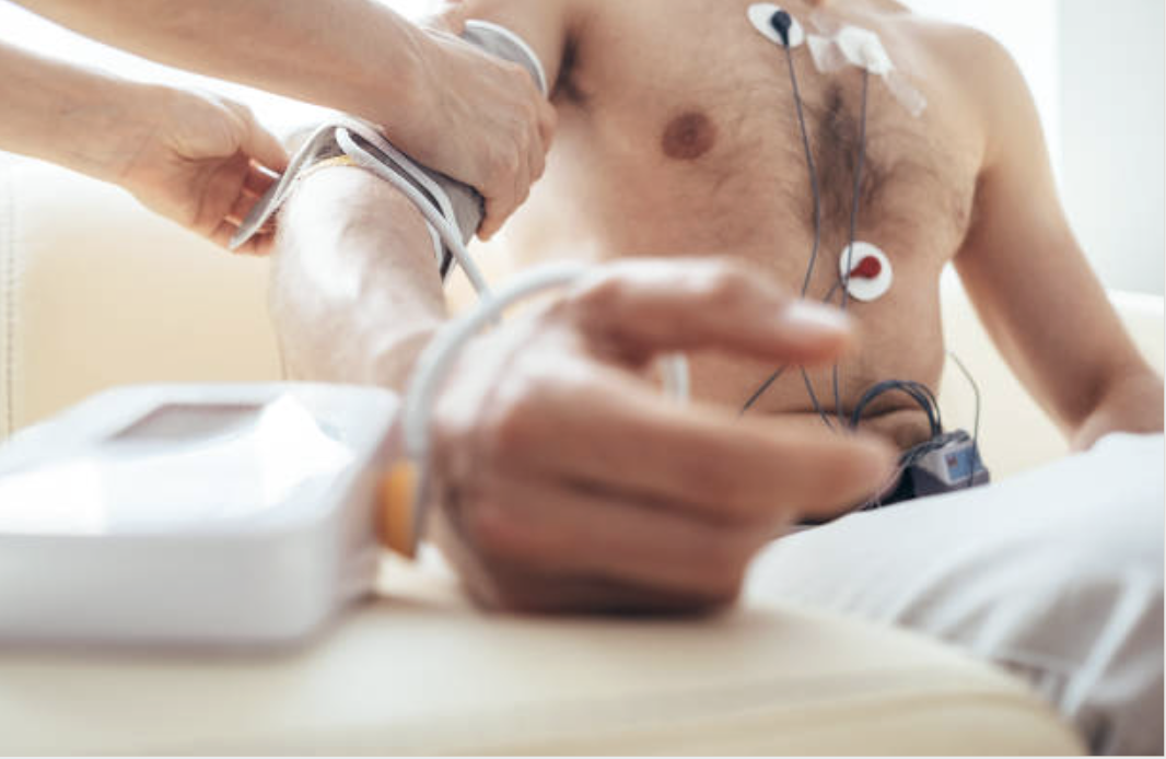 Holter Monitoring